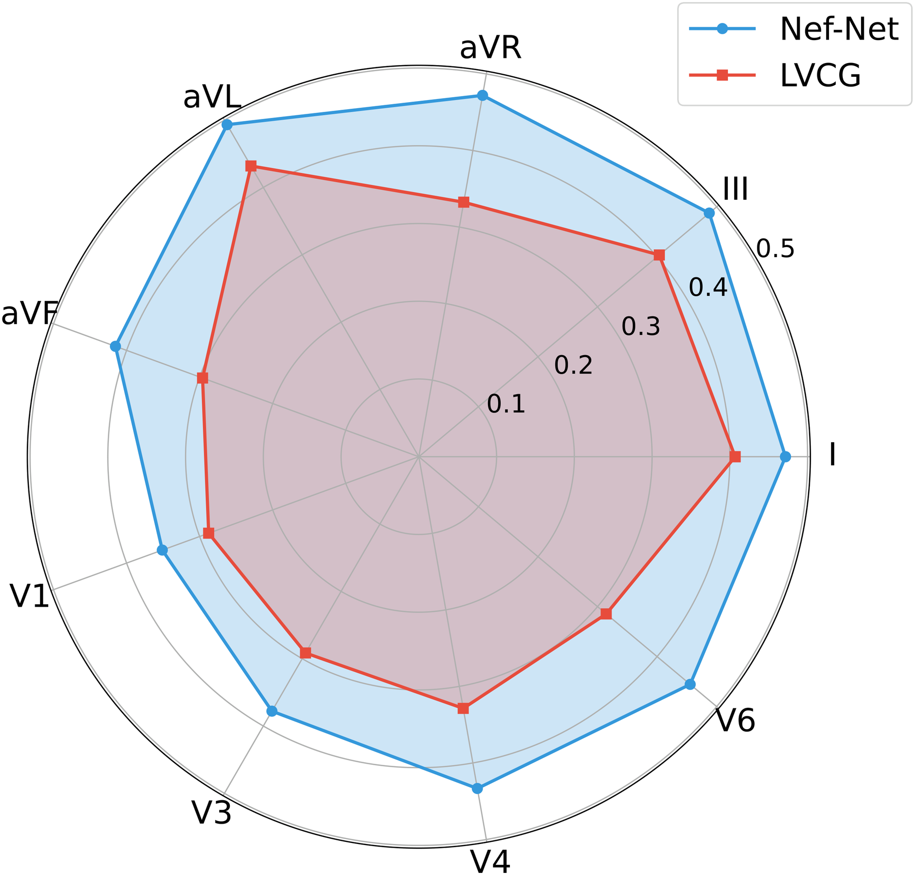 Per-lead reconstruction MAE radar